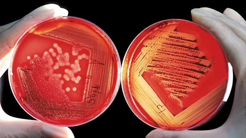 Aminoglycoside monitoring: peak, trough, ototoxicity and nephrotoxicity 2026